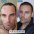 Celebrity Actor Before After Photos FUE Hair Transplant Orange County  & Los Angeles Dr. Rob Berberian Celebrity Actor Before After Photos FUE Hair Transplant Orange County  & Los Angeles Dr. Rob Berberian