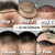 FUE Hair Transplant Newport Beach Orange County California Dr. Rob Berberian FUE Hair Transplant Newport Beach Orange County California Dr. Rob Berberian