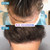 FUE Hair Transplant Newport Beach Orange County California Dr. Rob Berberian FUE Hair Transplant Newport Beach Orange County California Dr. Rob Berberian
