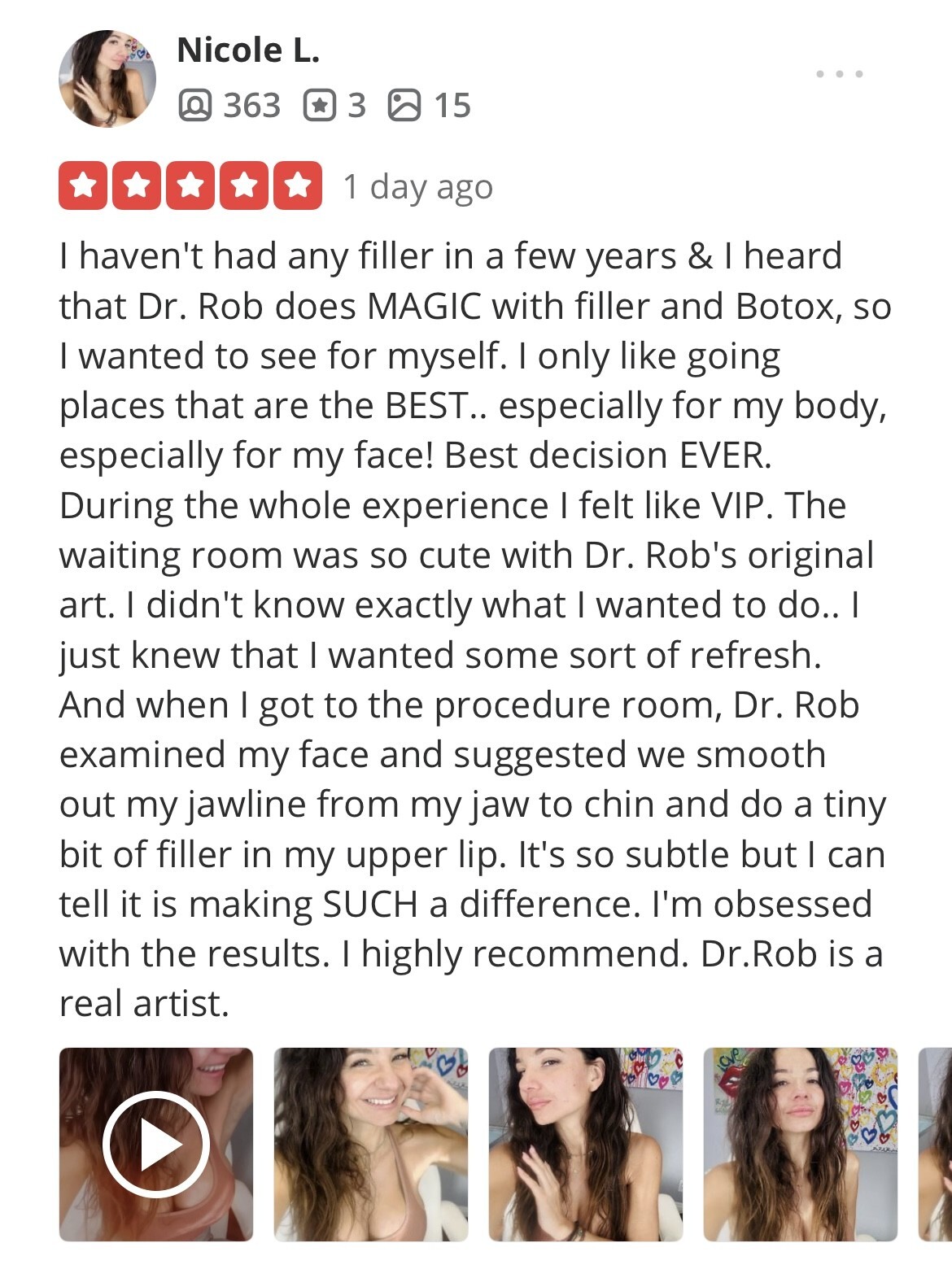 Dr. Rob Berberian Lip Filler Lip Flip Newport Beach Los Angeles California