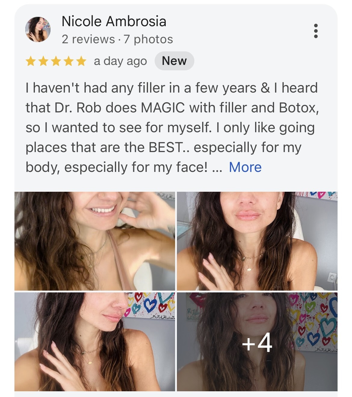 Dr. Rob Berberian - 5 Stars - Reviews - Lip Filler Newport Beach