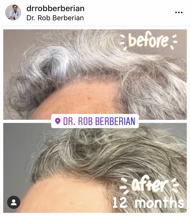 dr.-rob-berberian-hair-transplant-1.jpg