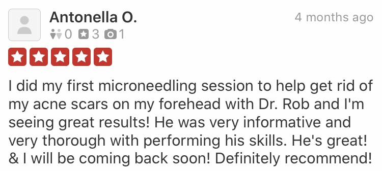 testimonial-yelp-review-dr.-rob-berberian-a-microneedling.jpg