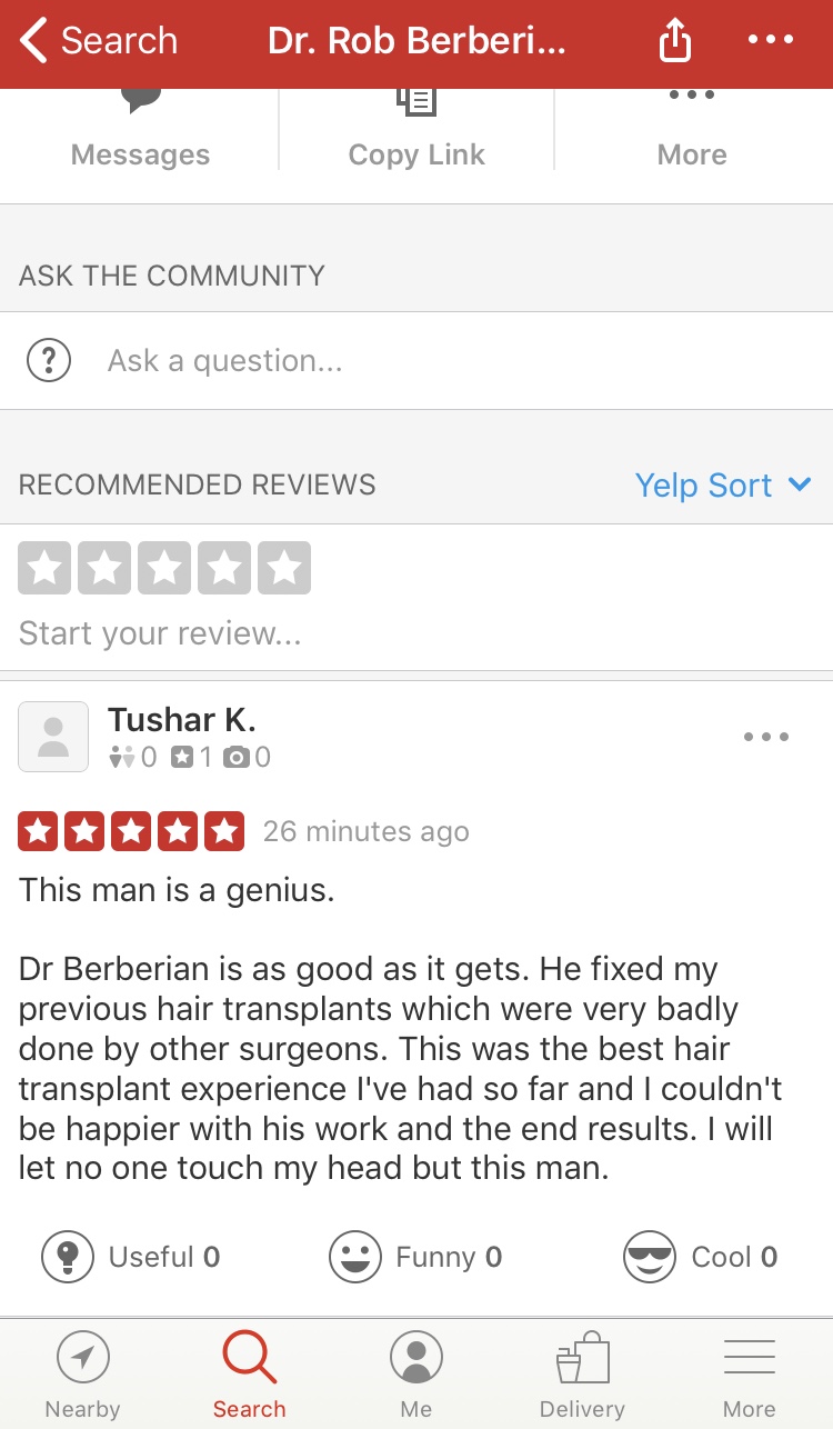 yelp-review-dr.-rob-berberian-hair-transplant-1.jpg