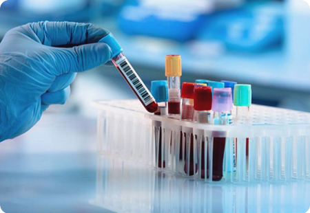 Lab Draw
