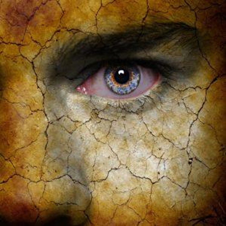 Occasional Dry Eye vs. Seasonal Allergies: Symptoms, Causes, and Solutions