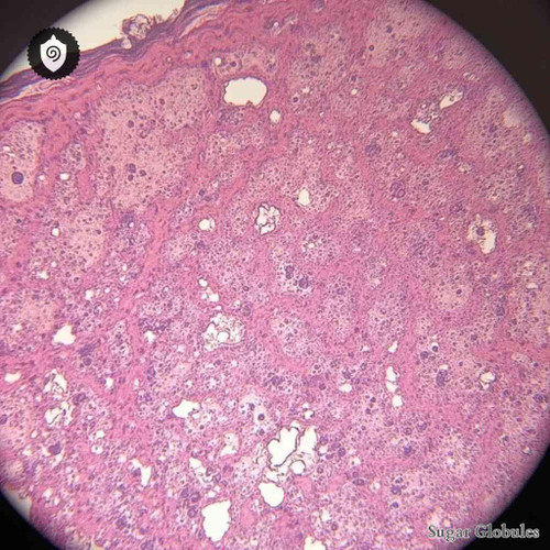 Carcinosinum Epithelioma Spinocellulare Pulmis sugar spheres in pellet form for energetic homeopathic (nonmedical) dry storage
