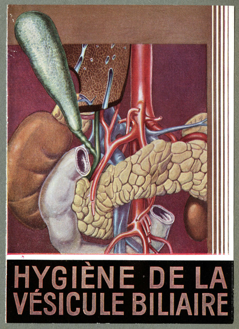 Gallery Edition study of Anonymous's Hygiène de la vésicule biliaire.