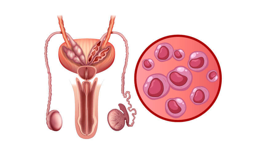 Understanding Chlamydia: A Supportive Guide to Sexual Wellness