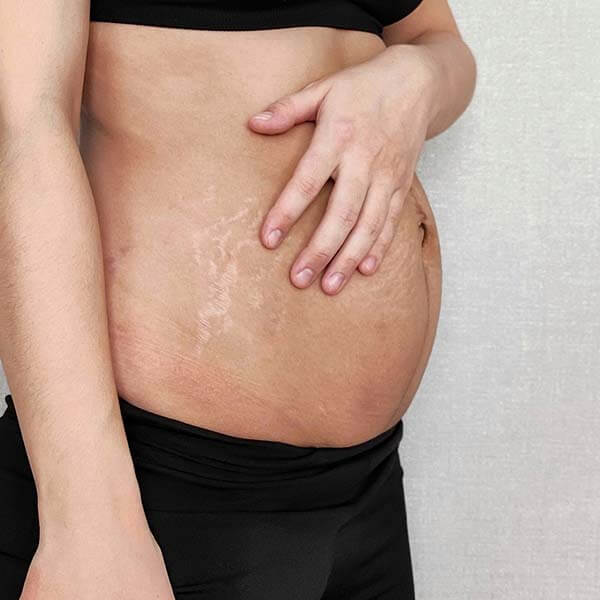 Postpartum Recovery