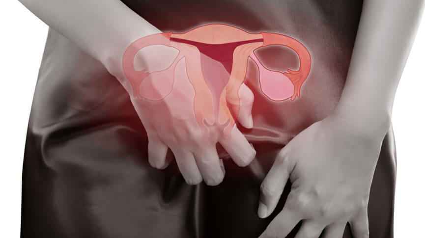 Vaginal Dryness