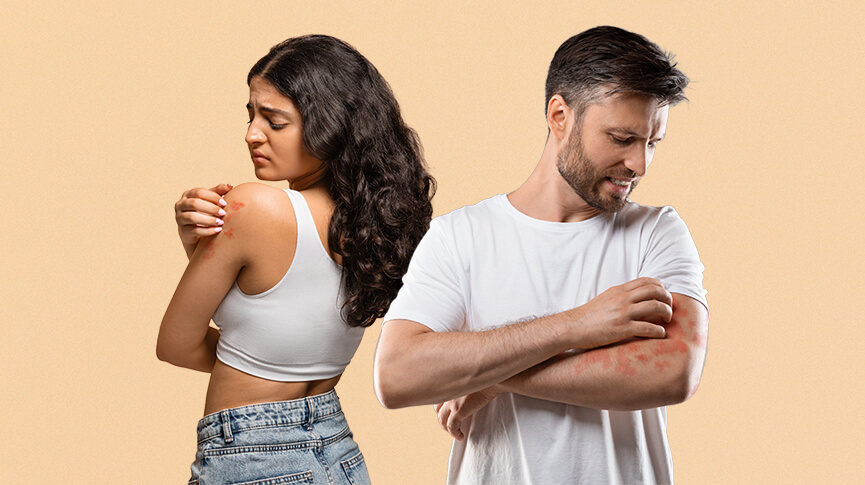 Psoriasis and Intimacy: Breaking the Stigma