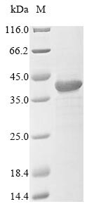 (Tris-Glycine gel) Discontinuous SDS-PAGE (reduced) with 5% enrichment gel and 15% separation gel.