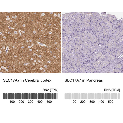 Immunohistochemistry analysis in human cerebral cortex and pancreas tissues using HPA063679 antibody. Corresponding SLC17A7 RNA-seq data are presented for the same tissues.