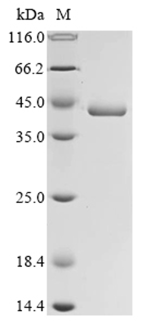 (Tris-Glycine gel) Discontinuous SDS-PAGE (reduced) with 5% enrichment gel and 15% separation gel.