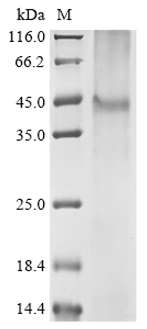 (Tris-Glycine gel) Discontinuous SDS-PAGE (reduced) with 5% enrichment gel and 15% separation gel.