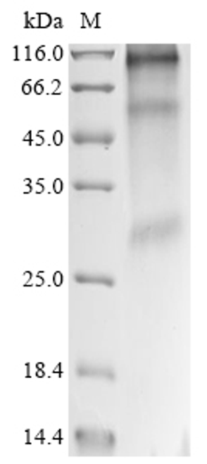 (Tris-Glycine gel) Discontinuous SDS-PAGE (reduced) with 5% enrichment gel and 15% separation gel.