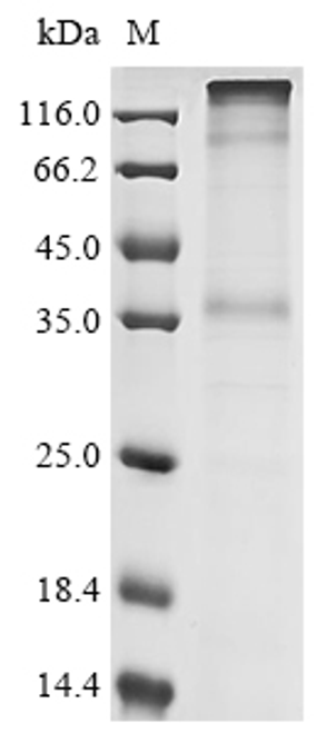 (Tris-Glycine gel) Discontinuous SDS-PAGE (reduced) with 5% enrichment gel and 15% separation gel.