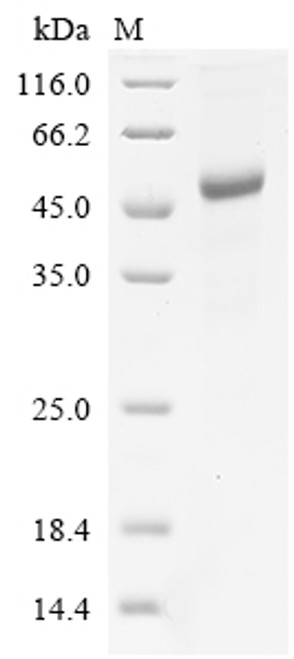 (Tris-Glycine gel) Discontinuous SDS-PAGE (reduced) with 5% enrichment gel and 15% separation gel.