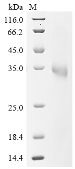 (Tris-Glycine gel) Discontinuous SDS-PAGE (reduced) with 5% enrichment gel and 15% separation gel.
