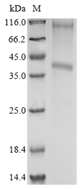 (Tris-Glycine gel) Discontinuous SDS-PAGE (reduced) with 5% enrichment gel and 15% separation gel.