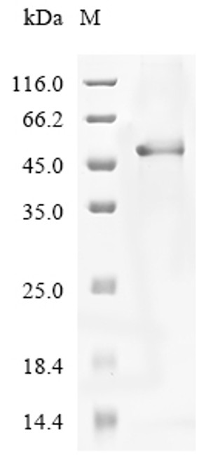 (Tris-Glycine gel) Discontinuous SDS-PAGE (reduced) with 5% enrichment gel and 15% separation gel.