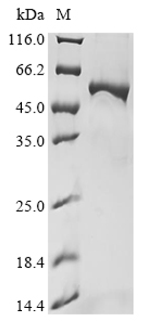 (Tris-Glycine gel) Discontinuous SDS-PAGE (reduced) with 5% enrichment gel and 15% separation gel.