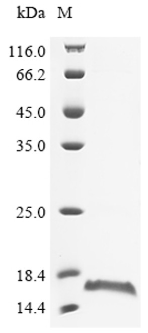 (Tris-Glycine gel) Discontinuous SDS-PAGE (reduced) with 5% enrichment gel and 15% separation gel.