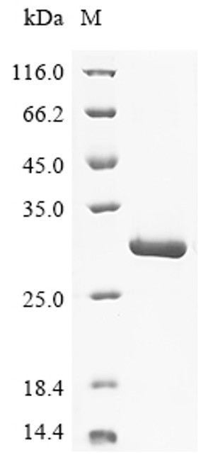 (Tris-Glycine gel) Discontinuous SDS-PAGE (reduced) with 5% enrichment gel and 15% separation gel.