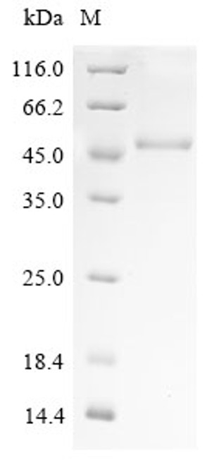 (Tris-Glycine gel) Discontinuous SDS-PAGE (reduced) with 5% enrichment gel and 15% separation gel.