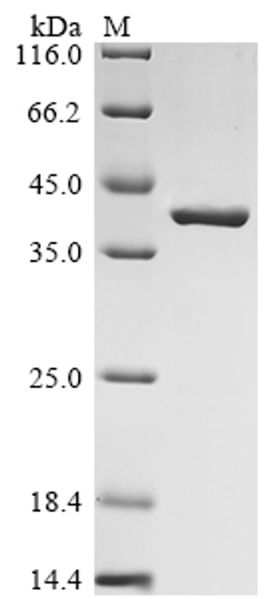 (Tris-Glycine gel) Discontinuous SDS-PAGE (reduced) with 5% enrichment gel and 15% separation gel.