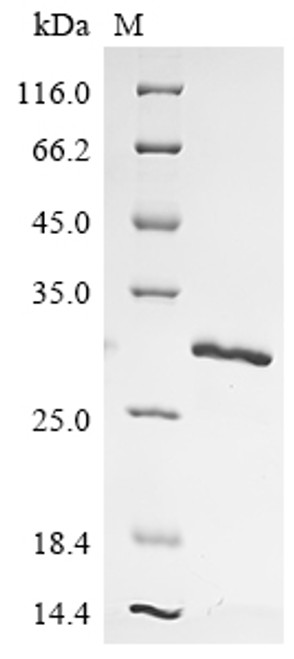 (Tris-Glycine gel) Discontinuous SDS-PAGE (reduced) with 5% enrichment gel and 15% separation gel.