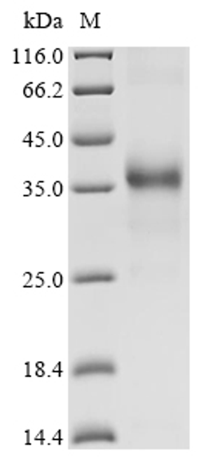 (Tris-Glycine gel) Discontinuous SDS-PAGE (reduced) with 5% enrichment gel and 15% separation gel.