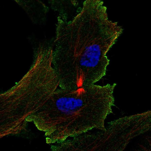 Immunofluorescent staining of human cell line ASC52telo shows localization to plasma membrane.