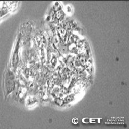 Human HepG2 Hepatocellular Carcinoma Cells