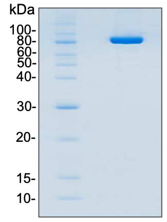 SP6 RNA polymerase,His-tagged