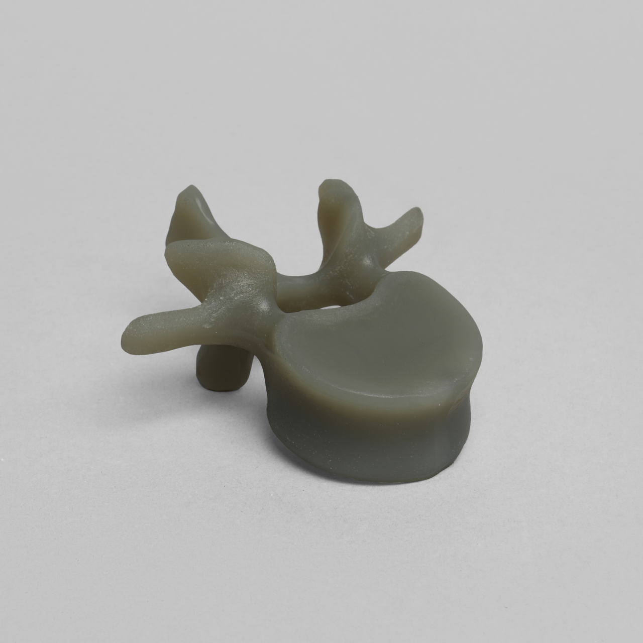 Lumbar Vertebra L1 Model (3429-1) | Sawbones