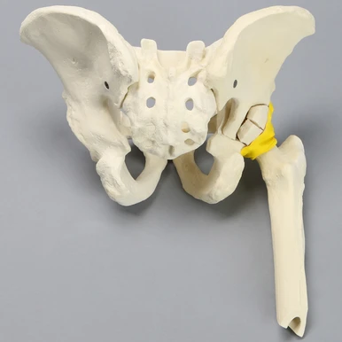 骨盤骨折 = Fractures of the pelvis and acet… Full Male Pelvis Model, Acetabular Fracture | Sawbones