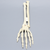 Hand and Wrist with Four-Part Fracture with Displacement, Foam Cortical Hand and Wrist with Four-Part Fracture with Displacement, Foam Cortical