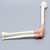 Arthroscopy Elbow Insert Arthroscopy Elbow Insert
