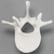 Vertebra, L1, Solid White Plastic Vertebra, L1, Solid White Plastic