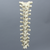 Spine, Thoracic, Foam Cortical Shell Spine, Thoracic, Foam Cortical Shell