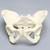 Pelvis with Dysplasia, Full Female, Solid Foam Pelvis with Dysplasia, Full Female, Solid Foam