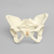 Pelvis with Dysplasia, Full Female, Solid Foam