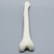 Femur with Cortex Wall Loss Femur with Cortex Wall Loss