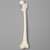 Femur with 40 Degree Deformity and Light Density Core, Medium Femur with 40 Degree Deformity and Light Density Core, Medium