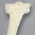 Tibia with Double Level Angulation Tibia with Double Level Angulation