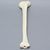 Tibia with 30 Degrees Varus Defect Tibia with 30 Degrees Varus Defect