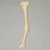 Tibia with Midshaft Malunion and 10º Varus Defect