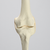 Knee with Three Stretch Tube Ligaments and Narrow Femoral Canal, Full Length Knee with Three Stretch Tube Ligaments and Narrow Femoral Canal, Full Length